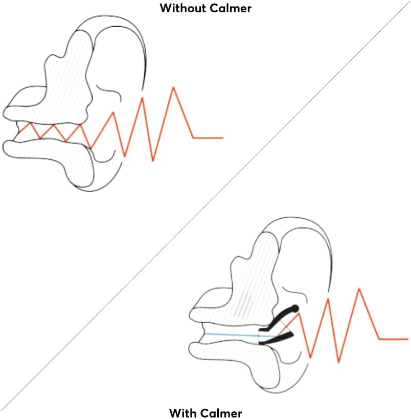 Calmer® Soft – Flare Audio