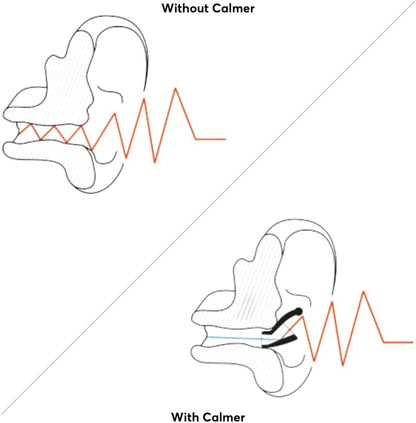 Calmer® Soft – Flare Audio