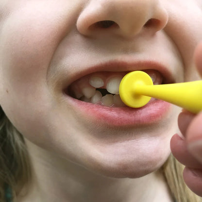 ARK proButton Set for Lip Closure and Strength
